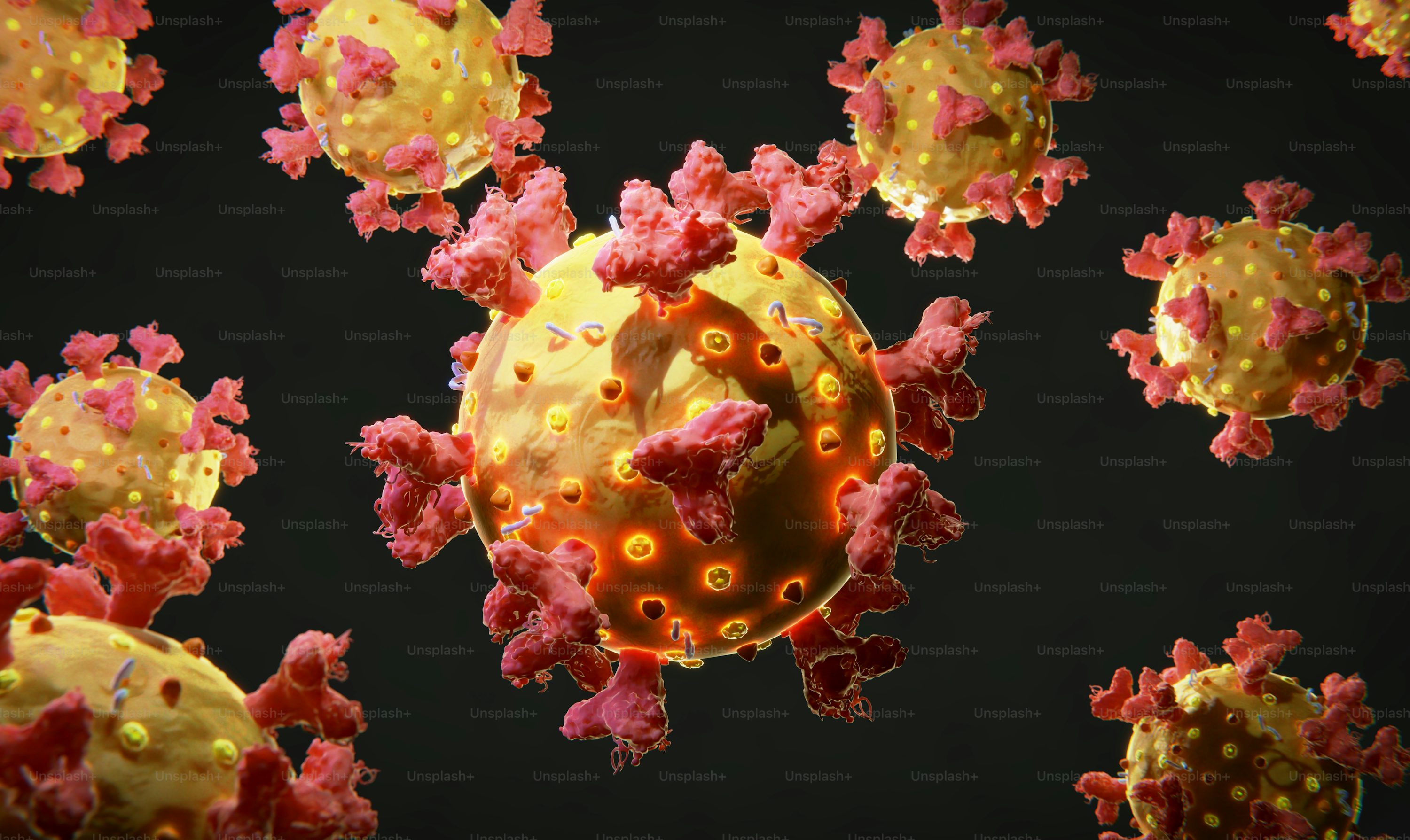 Amyloidosis