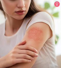 Sjogren's Syndrome